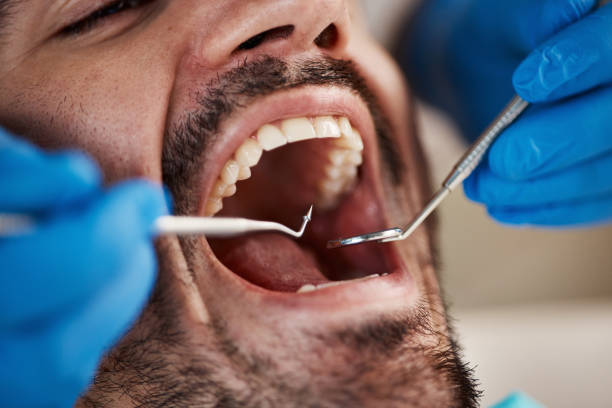 Best Walk-In Emergency Dental Services in Hutchins, TX
